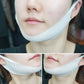 Premium Hydrogel Chin / V-line Mask